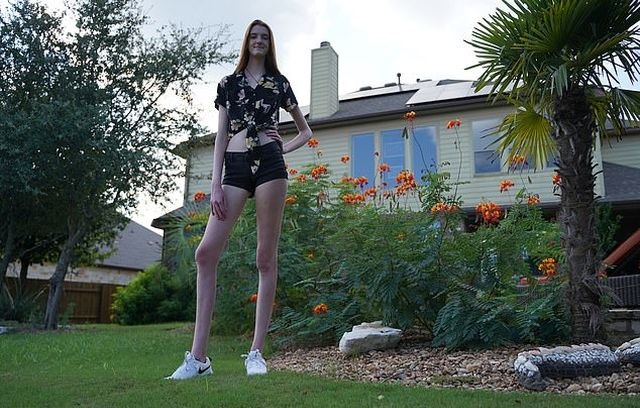 Маки Каррин &#8212; 17-летняя девушка с самыми длинными в мире ногами