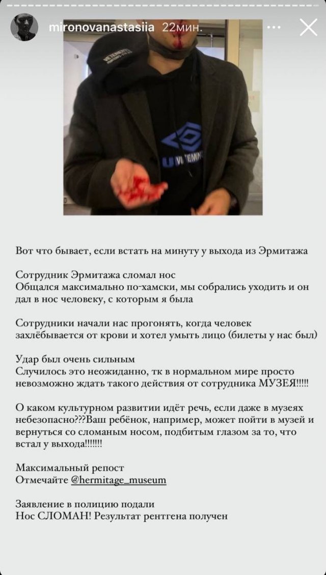 Блогер Анастасия Миронова рассказала как один охранник избил ее парня